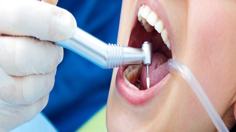root canal treatment,