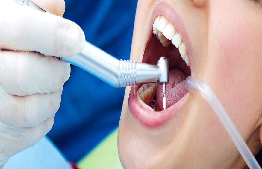 What is root canal treatment?