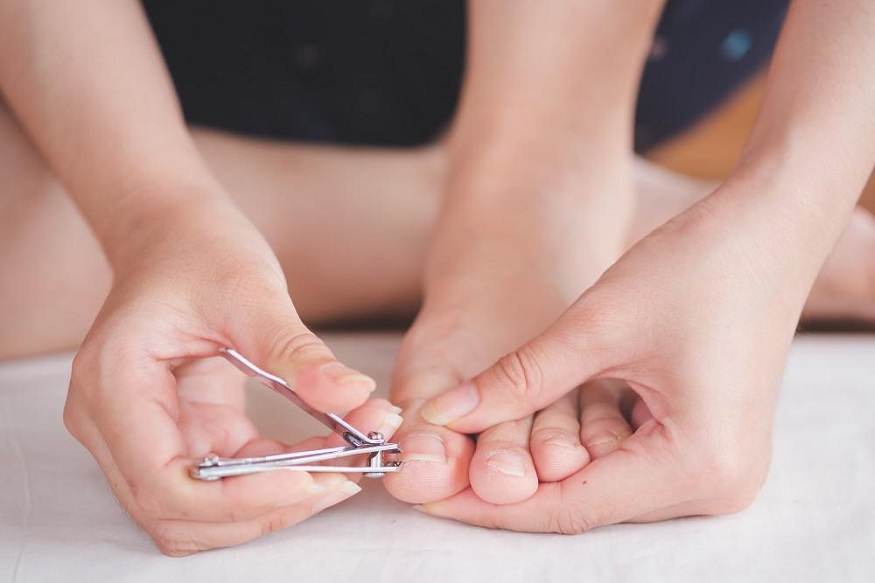 When To Seek a Doctor For Cutting an Ingrown Toenail  The typical curling ingrown toenail