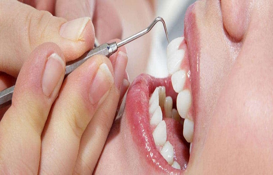 What Really Happens During a Dental Cleaning and Why You Shouldn’t Skip It